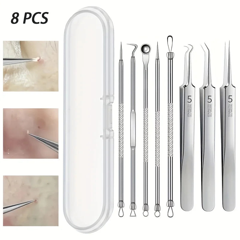 Kit 8 Outils Anti-Points Noirs – Extraction Pro en Acier Inoxydable