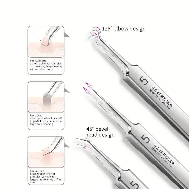 Kit 8 Outils Anti-Points Noirs – Extraction Pro en Acier Inoxydable